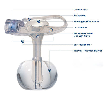 Steril Silikon Endotracheal Tube Disposable Button Gastrostomy Untuk Dewasa